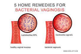 5 home remes for bacterial inosis