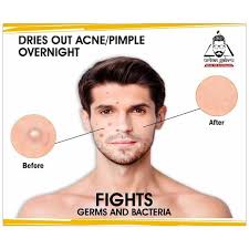 urban gabru acne pimple patch 100