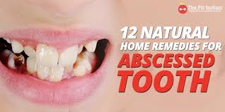 home remes for abscessed tooth