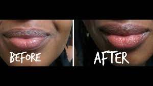 lips diy lip exfoliation with sugar