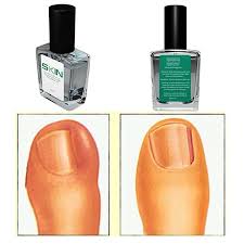 skinal toe nail softener ingrowing