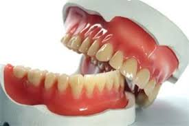 نتیجه تصویری برای پروتز دندان
