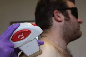 The most commonly treated areas for men are the neck, neckline, and beard. Laser Hair Removal Denver Laser Solutions