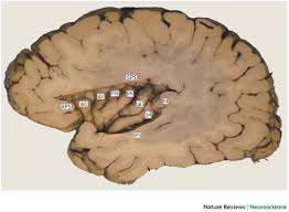 anterior insula and human awareness