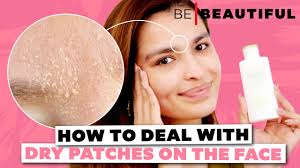 dry patches from your face