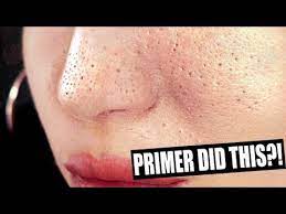 stop using pore minimizing primer if