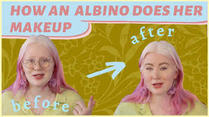 her makeup albinism makeup tutorial