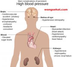 Salah satu cara yang disarankan adalah dengan makan makanan penurun darah tinggi, seperti tekanan darah normal berkisar di angka 120/80 mmhg. Pin On Cara Mengatasi Tekanan Darah Tinggi Atau Hipertensi