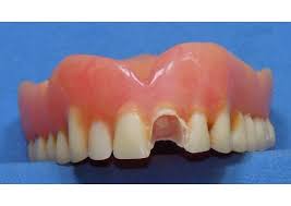 denture teeth repair broken denture