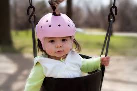 baby helmet therapy why it s needed