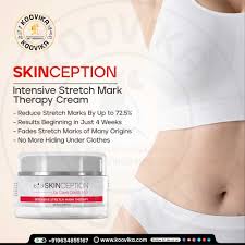 skinception intensive stretch mark