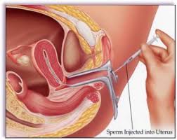 Image result for Self-Insemination