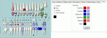 Open Dental Software Draw On Tooth Chart