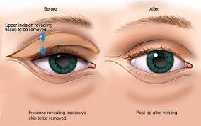 eye procedures at harbin clinic ent