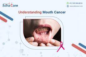 mouth cancer causes symptoms and