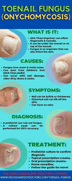 really bad toenail fungus causes