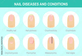 vector ilration nail diseases and