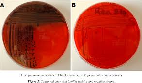 Hämta det här escherichia coli lactose positive grows on red agar endo fotot nu. Figure 2 From Study Of Biofilm Production And Antimicrobial Resistance Pattern Of Klebsiella Pneumoniae Isolated From Urinary Catheter At The University Hospital Of Tlemcen Semantic Scholar