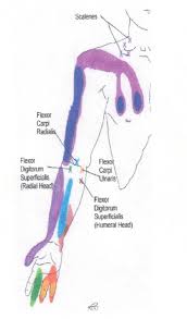 Neck Shoulder Arm And Hand Trigger Point Chart 2