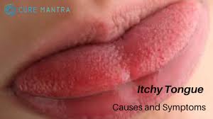 itchy tongue causes symptoms