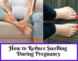 how to reduce swelling during pregnancy