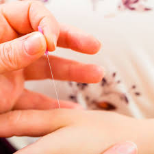 l acupuncture pendant la grossesse