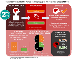 visualabstract thrombolysis guided by