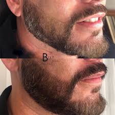 men s microblading beard and mustache