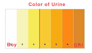 urine bright yellow or dull yellow