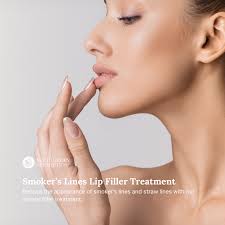 fillers for smoker s lines skin