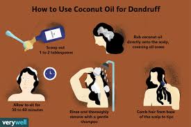efficacy of coconut oil for dandruff