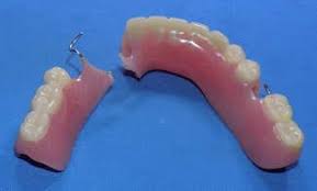 partial denture dental bridge repair