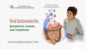 viral gastroenteritis symptoms causes