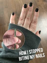 biting your nails how i stopped biting