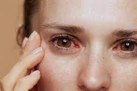 eye allergies most common reasons for