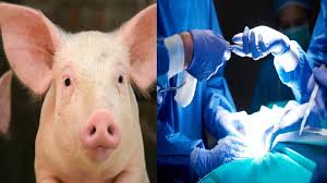 Surgeons In The US Transplant Pig's Kidney To Human For The First Time