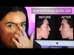 non surgical nose job liverpool
