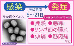 日本国内でも感染者！エムポックス（サル痘）の症状・ワクチン・治療薬、そして感染対策について | NHK健康チャンネル
