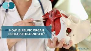 how is pelvic organ prolapse diagnosed