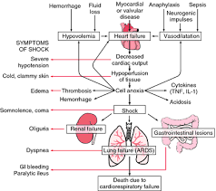 Hypovolemic Shock Definition Of Hypovolemic Shock In The