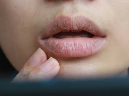 dry mouth xerostomia explained