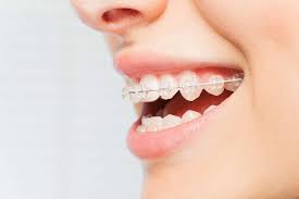 how to straighten uncentered teeth when