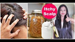 get rid of itchy scalp fast best tips