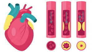 lipid panel cholesterol test ranges