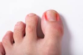 stubbed toe to bone infection in 3 too