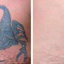 Robert young's plastic surgery and med spa practice, our team is expertly trained and experienced in utilizing the piqo4 laser, one of the most effective laser systems for tattoo removal in san antonio, tx. Tatto Wallpapers San Antonio Tattoo