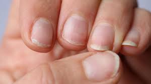how to prevent brittle nails 5 tips to