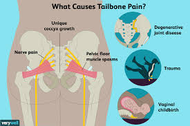 tailbone pain coccydynia causes and