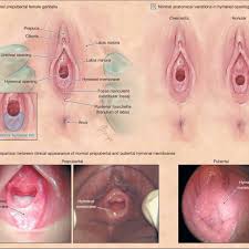 A lesson in female anatomy. Female Prepubertal Genital Anatomy Download Scientific Diagram