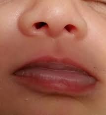 help babys lips look bluish